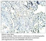 SPHK1 Antibody in Immunohistochemistry (IHC)