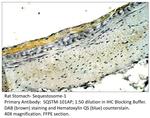 Sequestosome-1 Antibody in Immunohistochemistry (Paraffin) (IHC (P))