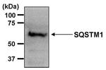 SQSTM1 Antibody in Western Blot (WB)