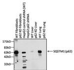 SQSTM1 Antibody in Western Blot (WB)