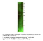 SRD5A3 Antibody in Western Blot (WB)