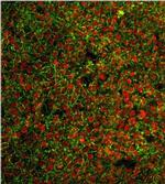 SSEA3 Antibody in Immunocytochemistry (ICC/IF)