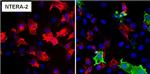 SSEA5 Antibody in Immunocytochemistry (ICC/IF)