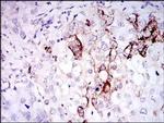 Somatostatin Antibody in Immunohistochemistry (Paraffin) (IHC (P))