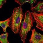 STAT3 Antibody in Immunocytochemistry (ICC/IF)