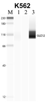 SUZ12 Antibody in Immunoprecipitation (IP)