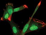 SMAD3 Antibody in Immunocytochemistry (ICC/IF)