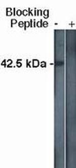 SPHK1 Antibody in Western Blot (WB)