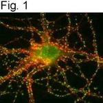 SynGAP Antibody in Immunocytochemistry (ICC/IF)