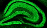 SynGAP Antibody in Immunohistochemistry (IHC)