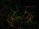 Synapsin 1 Antibody in Immunocytochemistry (ICC/IF)