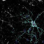 Synaptophysin Antibody in Immunocytochemistry (ICC/IF)