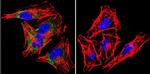 SNTB2 Antibody in Immunocytochemistry (ICC/IF)