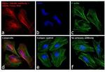 Mouse IgG (H+L) Cross-Adsorbed Secondary Antibody in Immunocytochemistry (ICC/IF)