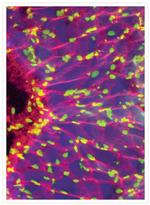 Mouse IgG (H+L) Cross-Adsorbed Secondary Antibody in Immunohistochemistry (IHC)