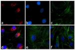 Rabbit IgG (H+L) Cross-Adsorbed Secondary Antibody in Immunocytochemistry (ICC/IF)