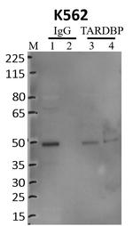 TDP-43 Antibody in Immunoprecipitation (IP)