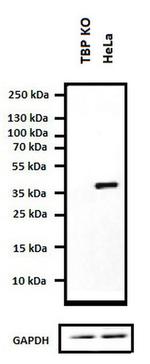 TBP Antibody