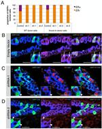 TBX3 Antibody in Immunohistochemistry (Paraffin) (IHC (P))