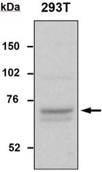 TDP1 Antibody in Western Blot (WB)