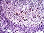 LAP (Latency Associated Peptide) Antibody in Immunohistochemistry (Paraffin) (IHC (P))