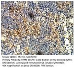 Themis Antibody in Immunohistochemistry (IHC)