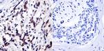 TIMP1 Antibody in Immunohistochemistry (Paraffin) (IHC (P))