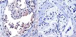 TIMP1 Antibody in Immunohistochemistry (Paraffin) (IHC (P))