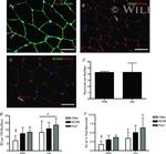 c-Met Antibody in Immunohistochemistry (IHC)