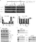 SERCA1 ATPase Antibody in Western Blot (WB)