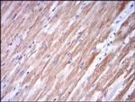 TNNI2 Antibody in Immunohistochemistry (Paraffin) (IHC (P))