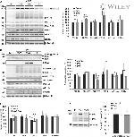 Ubiquilin 2 Antibody in Western Blot (WB)