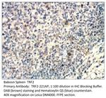 TRF2 Antibody in Immunohistochemistry (IHC)