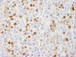 TRIP1/SUG1 Antibody in Immunohistochemistry (IHC)