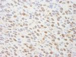 TRIP1/SUG1 Antibody in Immunohistochemistry (IHC)