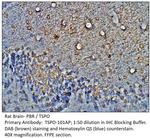 PBR Antibody in Immunohistochemistry (IHC)