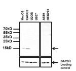 TTR Antibody in Western Blot (WB)