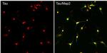 Tau Antibody in Immunocytochemistry (ICC/IF)