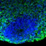 Tau Antibody in Immunohistochemistry (Frozen) (IHC (F))