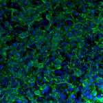 Tau Antibody in Immunohistochemistry (Frozen) (IHC (F))