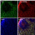 Tau Antibody in Immunohistochemistry (Frozen) (IHC (F))