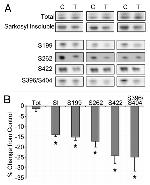 Phospho-Tau (Ser262) Antibody in Western Blot (WB)