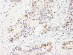 UBE1 Antibody in Immunohistochemistry (IHC)