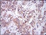 UBC9 Antibody in Immunohistochemistry (Paraffin) (IHC (P))