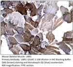 UBR1 Antibody in Immunohistochemistry (IHC)