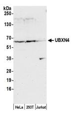 UBXN4 Antibody in Western Blot (WB)