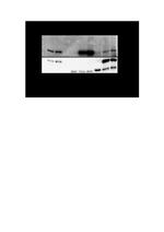 USP17L2 Antibody in Western Blot, Immunoprecipitation (WB, IP)