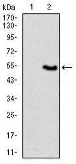 VAV1 Antibody in Western Blot (WB)