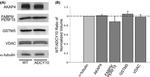 VDAC Antibody in Western Blot (WB)