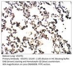 VEGFR1 Antibody in Immunohistochemistry (IHC)